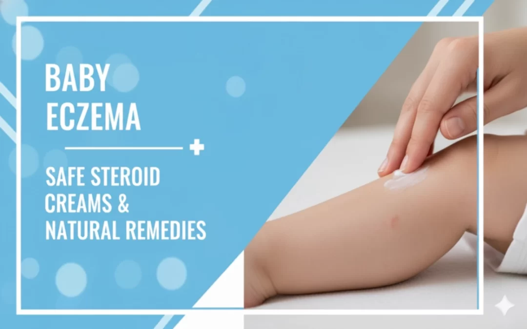 Baby Eczema: Safe Steroid Creams & Natural Remedies